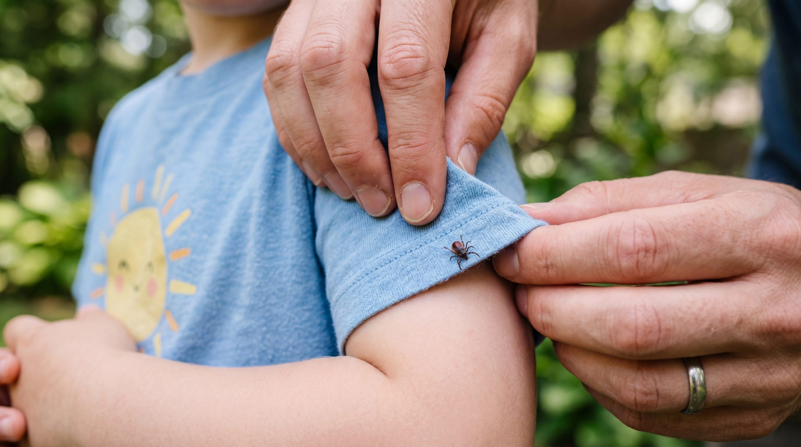 lyme-disease-in-children-symptoms-parents-should-know